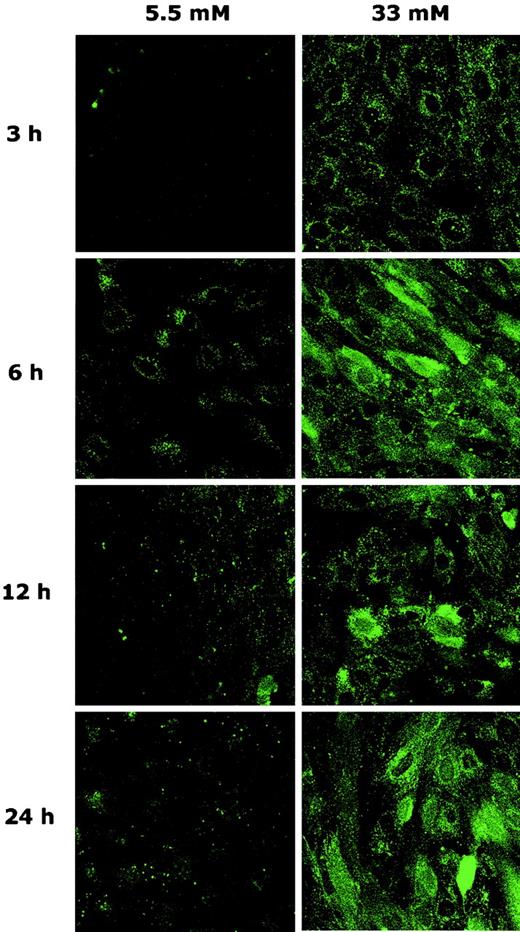 FIG. 9. Assay of ROS accumulation in cells exposed to high levels of glucose. Cells exposed to 5.5 mmol/l as control or high levels of glucose such as 22 and 33 mmol/l glucose for varying time periods as indicated were subjected to carboxyl-H2-DCFDA exposure for 1 h before the end of each exposure. Each culture was first checked by a phase-contrast microscope to ensure that the cell density among the cultures were comparable. The fluorescence was then detected by a confocal microscope as shown. The staining intensity thus corresponds to the extent of ROS accumulation. Original magnification ×63.