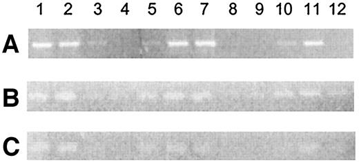 FIG. 4. Tissue-specific expression pattern of Ian1 and -4. PCR analysis on tissue-specific cDNA pools for Ian1 (A), Ian4 l (B), and Ian4S (C). The lanes are: lane 1, spleen; lane 2, thymus; lane 3, liver; lane 4, brain; lane 5, kidney; lane 6, heart; lane 7, lung; lane 8, testis; lane 9, skin; lane 10, stomach; lane 11, small intestine; lane 12, muscle.