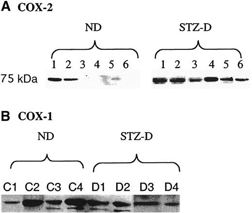 FIG. 4. Western blot analysis of COX protein abundance in ND and STZ-D rat sciatic nerve. Protein extracts of rat sciatic nerve were separated by electrophoresis on a 7.5% SDS-polyacrylamide gel and transferred to a PVDF membrane. After blocking, blots were incubated with polyclonal anti-COX-2 (A) and anti-COX-1 (B) antibodies, washed, and incubated with the appropriate HRP-conjugated secondary antibody (see research design and methods for details). Blots were analyzed with a luminol chemiluminescence detection kit.