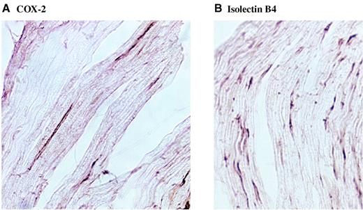 FIG. 5. Immunohistochemical localization of COX-2 in rat sciatic nerve. Goat polyclonal antibody against COX-2 (A) was used to immunostain fresh frozen sections of STZ-D rat sciatic nerve (see research design and methods). Immunostaining for Isolectin B4 (B) was used as an anatomical marker for endothelial cells.
