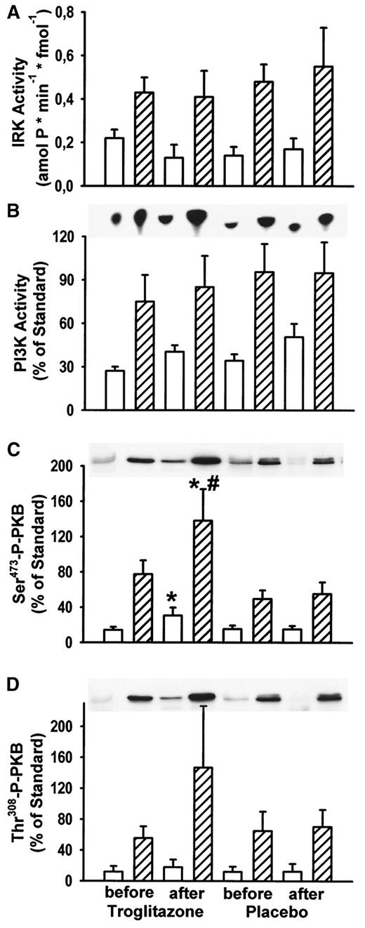 FIG. 2. Insulin signaling. Muscle biopsies obtained at basal (□) or steady-state clamp insulin concentrations ([cjs2113]) before and after 3 months of troglitazone or placebo treatment were solubilized, and IRK activity (A), IRS-1-associated PI3K activity (B), and Ser473 (C) or Thr308 phosphorylation (D) of PKB were measured as described. Data represent means ± SE. *P < 0.05 compared with respective pretreatment value; #P < 0.05 compared with placebo treatment.