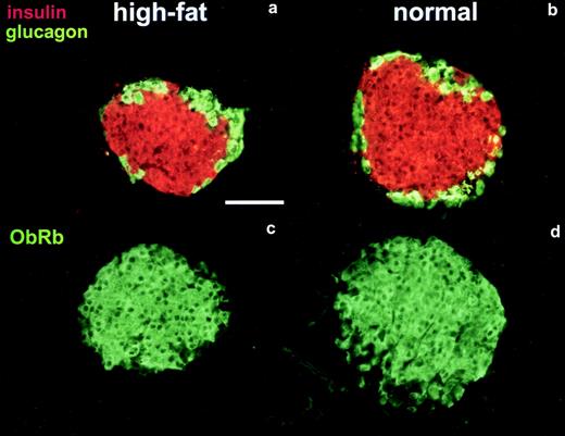 FIG. 2. Immunofluorescence staining of pancreatic sections from high-fat–fed and control mice after 8 weeks. A and B: Results of a double-staining experiment for insulin and glucagon. Insulin (red staining) is contained in the core zone of the islet, while glucagon (green staining) is found in the mantle zone. The cytoarchitecture of the islet does not seem to be disturbed in response to dietary treatment. ObRb staining is shown in high-fat diet (C) and controls (D). No apparent difference in staining intensity or localization could be found. Scale bar = 200 μm.