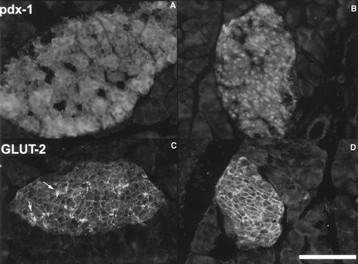 FIG. 3. Immunofluorescence staining of pancreatic sections from high-fat–fed and control mice after 8 weeks. A and B: Staining for pdx-1. Immunoreactivity for pdx-1 was found mainly in the cytoplasm of cells in the core zone of the islets. Nuclear staining was very weak in these specimens. In contrast, in controls, nuclear pdx-1 staining in some of the islets was markedly enhanced, with less intense staining of the cytoplasm. C and D: GLUT2 immunoreactivity. Membranous GLUT2 staining was much weaker in high-fat islets (C) than in controls (D). Furthermore, an accumulation of immunoreactive material could be found in the core of high-fat islets (arrows). Scale bar = 200 μm.