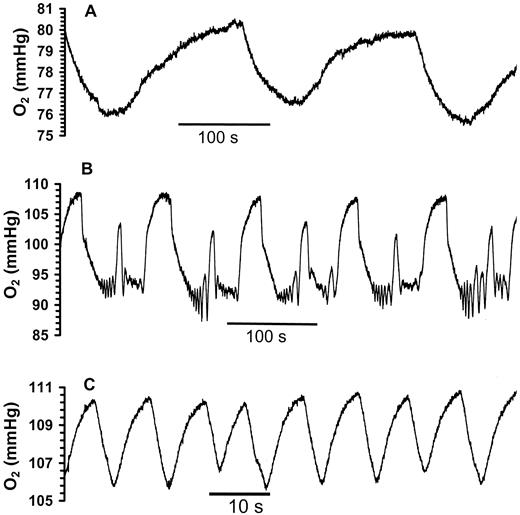 FIG 1. Glucose-stimulated oxygen oscillations. Oxygen measurements were made with a 1- to 3-μm diameter sensor implanted 50–75 μm deep into individual mouse islets. Islets were perfused with 10 mmol/l glucose in Krebs-Ringer buffer containing 2.4 mmol/l Ca2+ at 37°C. Recordings are shown after regular oscillations began. Oxygen levels represent the balance of consumption and resupply by diffusion through the islet. The decreases in oxygen level correspond to increases in consumption relative to transport into the islet. Once consumption decreases, the oxygen level increases as diffusion into the islet restores the original balance of transport and consumption. The different patterns of oxygen oscillations observed in single islets are slow oscillations with a period of ∼3 min (A), slow oscillations with fast fluctuation occurring during the decreases (B), and fast oscillations with a period of 8–30 s (C).