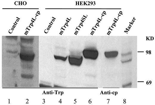 FIG 3. mSTRPC4 l protein expressed in CHO and HEK293 cells. Cell lysates were prepared from stable cell lines expressing mSTRPC4 l and fractionated by SDS-PAGE (7.5% gel). Lanes 1 and 2 are CHO cells in a separate experiment, and lanes 4 and 5 were from two independent cell lines. Western blots were probed with anti-m STRPC4 NH2-terminal antipeptide antisera. Lanes 1 and 3, nontransfected control. Lanes 7 and 8, antitag (anti–COOH-terminal tag) antisera.