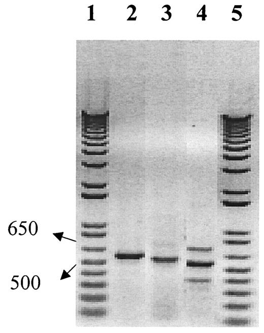 FIG 5. LTRPC2 (TrpC7) is expressed in human islets. RNA was extracted from the human islets using Trizol reagent. The cDNA was obtained with random primers and oligodT primers (not shown). For PCR analysis of LTRPC2 expression, we used three forward primers and one reverse, as described in the text, to produce three bands of 584, 562, and 544 bp (lanes 2–4). The amplified fragment (lane 2, 584 bp) was purified and fully sequenced in both directions using For22 and Rev584. The oligodT-directed cDNA did not yield any specific products. Lanes 1 and 5 are cDNA standards, with two of the bands indicated at 500 and 650 bp.