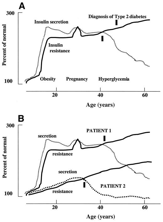 FIG. 3. Evolution of insulin resistance and secretion with age in a putative case (Patient 1) of juvenile obesity leading to type 2 ODDM in mid-adulthood (A) and in a sibling who also developed type 2 diabetes (Patient 2) (B).