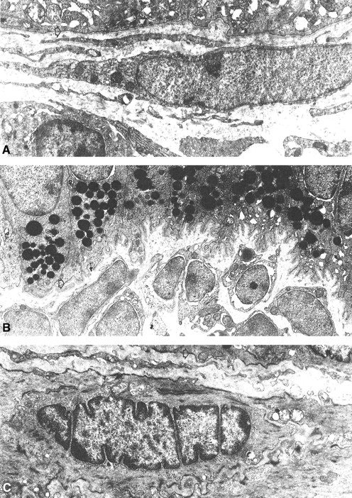 FIG. 3. Electron photomicrographs (×11.6–17.2 k magnification) of basal pole regions of endometrial epithelial cells from control (+/?; A) and diabetic (db/db; B) mice at age 8 weeks. Although cytoplasmic nuclear and basal membrane laminations are indicated by smooth surface layering supported by a homogenous basal lamina and stromal region in controls (A), the cytoarchitecture of diabetic (B) epithelial cells presented dramatic contrasts in shape and organization. Whereas dense accumulations of basal pole lipid vacuoles dominated the peristromal cytoplasmic region of endometrial epithelial cells, the basal membrane demonstrated an enhanced laminar folding pattern (open arrows) and spatial separation from the underlying stroma (C). Dense vacuole accumulations occurred in association with expressed hyperglycemia as well as elevated tissue lipoprotein lipase and triacylglycerol activities (Fig. 7) and accounted for the progressive enhancement of cytolipidemic volume measurements (Fig. 4).