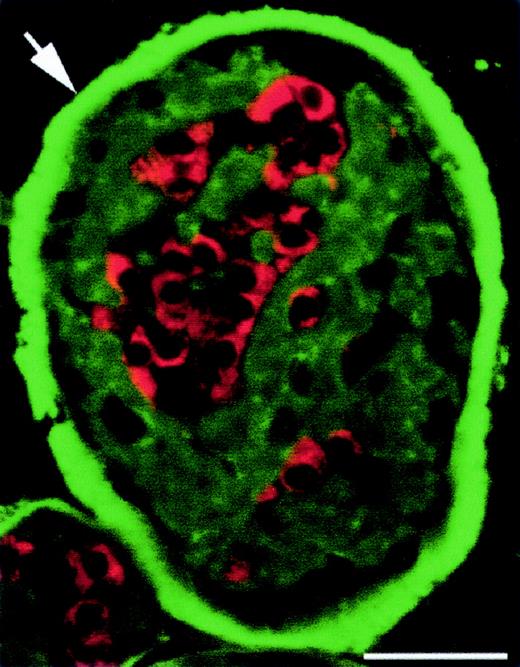 FIG. 6. IgG accumulates on alginate and NPCCs after transplantation. Immunostaining was performed without primary antibody, confirming that secondary antibody (FITC-conjugated anti-mouse antibody) binds to IgG that accumulated in vivo on the alginate and on the NPCCs (arrow indicates the thick layer of the IgG on the NPCC, and red staining represents insulin). Bar = 100 μm. Therefore, polyclonal antibodies were used for CK and Ki-67 immunostaining.