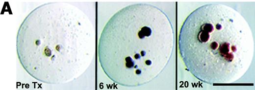 FIG. 5. β-Cells can differentiate within the Ba-alginate capsules. A: Dithizone-stained NPCCs in microcapsules indicated availability of insulin at 2, 6, and 20 weeks. Bar = 500 μm. B: A marked increase in the maturation of NPCCs (*P < 0.01 and **P < 0.001 versus pretransplantation), expressed as the “maturation index” (insulin-positive area divided by pan-CK-positive area), was determined. C: Representative sections of NPCCs showing before transplantation and an increase of the area of the positively stained cells for insulin 20 weeks after transplantation. Insulin (Texas Red) and pan-CK (FITC, green). Bar = 100 μm. D: Graft insulin content of encapsulated NPCCs increased after transplantation (*P < 0.001 compared with pretransplant level, n represents each mouse from which triplicate samples were analyzed). In NPCCs removed from noncured animals (data not included), insulin content was lower than in cured animals (P < 0.001). Pretransplantation insulin levels in NPCCs of unsuccessful experiments were also lower than in cured preparations.