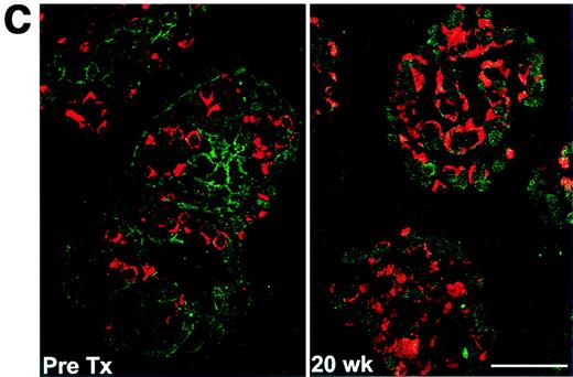 FIG. 5. β-Cells can differentiate within the Ba-alginate capsules. A: Dithizone-stained NPCCs in microcapsules indicated availability of insulin at 2, 6, and 20 weeks. Bar = 500 μm. B: A marked increase in the maturation of NPCCs (*P < 0.01 and **P < 0.001 versus pretransplantation), expressed as the “maturation index” (insulin-positive area divided by pan-CK-positive area), was determined. C: Representative sections of NPCCs showing before transplantation and an increase of the area of the positively stained cells for insulin 20 weeks after transplantation. Insulin (Texas Red) and pan-CK (FITC, green). Bar = 100 μm. D: Graft insulin content of encapsulated NPCCs increased after transplantation (*P < 0.001 compared with pretransplant level, n represents each mouse from which triplicate samples were analyzed). In NPCCs removed from noncured animals (data not included), insulin content was lower than in cured animals (P < 0.001). Pretransplantation insulin levels in NPCCs of unsuccessful experiments were also lower than in cured preparations.