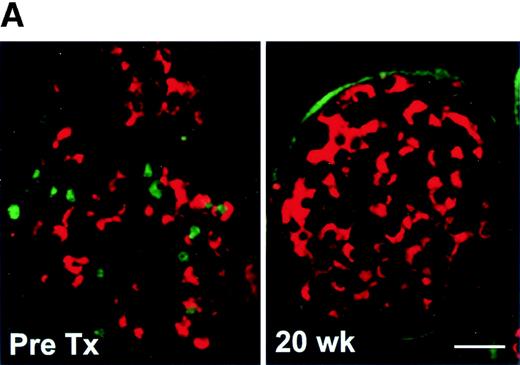 FIG. 7. Proliferation index of the β-cells decreased after transplantation. Double immunostaining for Ki-67 and insulin was used to measure the proliferation index of the β-cells (number of Ki-67-positive β-cells over the total number of β-cells). A: Representative sections of NPCCs stained for Ki-67 (FITC, green) and insulin (Texas Red), with the left panel an NPCC before transplantation and the right panel a graft 20 weeks after transplantation. Bar = 25 μm. B: Proliferation index of the β-cells decreased 20 weeks after transplantation as compared with pretransplantation and 6 weeks after transplantation; *P < 0.05 compared with pretransplantation or 6 weeks.