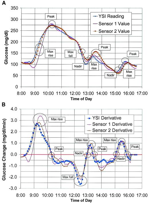 FIG. 1. A: Glucose concentration by simultaneous venous sampling and two continuous subcutaneous glucose sensors. B: The first derivatives of the glucose concentration curve from Fig. 1A.