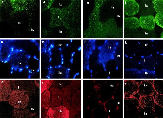 FIG. 3. Triple-immunofluorescent staining of serial sections. For all images, type I muscle fibers are stained green, type IIa muscle fibers are stained blue, and type IIx muscle fibers are unstained. Panels c and f show PGC-1 before and after endurance training, respectively. Panels i and l show PPAR-α before and after endurance training, respectively.