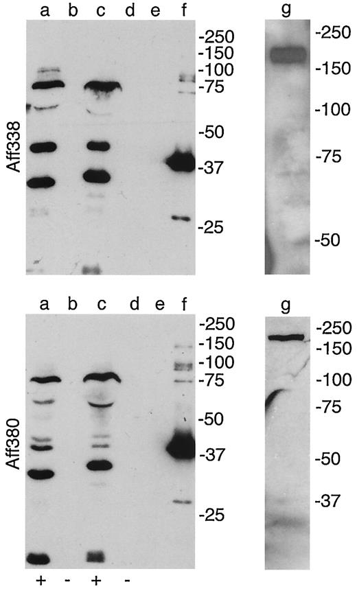 FIG. 3. Western blots showing the characteristic banding patterns of urine samples of individual nephrinuric diabetic patients (lanes a and c) stained with both anti-nephrin antibodies Aff338 and Aff380. The immunization antigen of the antibodies, α-435 (37 kDa), is in lane f, and full-length nephrin (185 kDa) is in lane g. Lanes b and d represent patient samples regarded as nonnephrinuric; lane e consists of Laemmli sample buffer without urinary sample. Molecular weights of the molecular standard are indicated on the right.