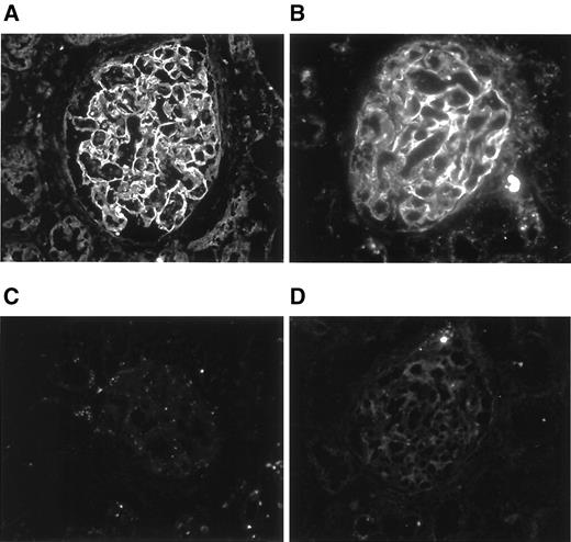FIG. 4. Immunofluorescence stainings of human kidney cortex cryostat sections with anti-nephrin antibodies Aff338 (A) and Aff380 (B) showing a typical epithelial staining pattern. Control stainings without a primary antibody (C) or with an irrelevant anti-human glucagon antibody (D) exhibited negligible staining of the glomeruli. Magnification ×400 in A and ×600 in B.
