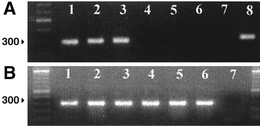 FIG. 2. RT-PCR products of modified and unmodified islets amplified with primers specific for human MnSOD. Lanes 1–3: Three different groups of Ad-MnSOD-infected mouse islets. Lane 4: Unmodified controls. Lane 5: Ad-LacZ-infected islets. Lane 6: Mouse kidney. Lanes 7 and 8: Negative and positive controls. Panel B shows β-actin amplification of samples in panel A.