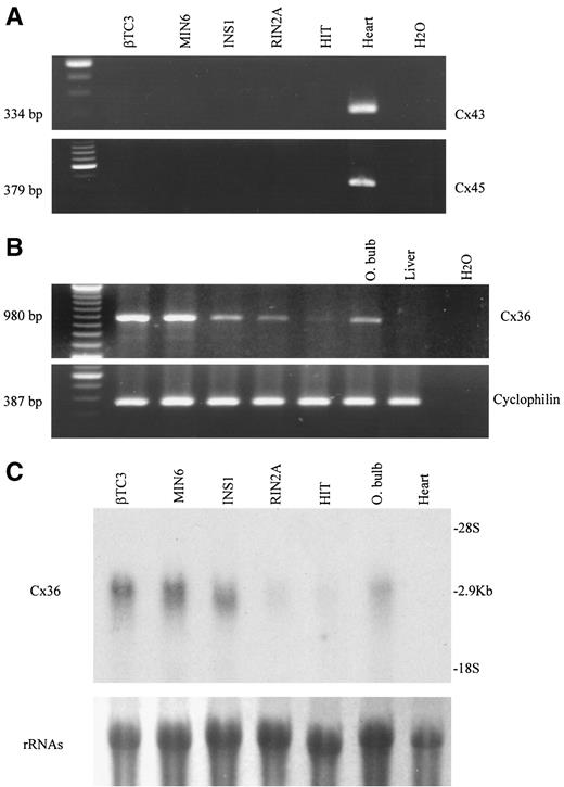 FIG. 1. Cx36 is the sole connexin detected in insulin-producing cell lines. A: RT-PCR amplification identified the transcript for Cx43 and Cx45 in heart but not in the insulin-secreting cell lines βTC3, MIN6, INS1, RIN2A, and HIT. B: When the RT-PCR was run with primers for Cx36, the connexin transcript was detected in olfactory bulb and in all the cell lines we investigated, but not in liver. Amplification of the same samples for cyclophilin was used to control the loading of each lane. Left lanes: size standards; right lanes: blank control (H2O). C: Northern blot analysis confirmed the expression of a Cx36 transcript in all the lines tested. However, the levels of this expression differed in the five lines. RNA from olfactory bulb and heart were used as positive and negative control, respectively. The methylene blue staining of ribosomal RNAs indicates a comparable loading of all samples.