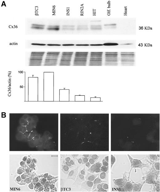 FIG. 2. Different insulin-producing cell lines express distinct levels of Cx36 protein. A: A few bands of ∼36 KDa were immunodetected in membrane extracts of the five lines tested, as well as in the olfactory bulb (upper panel). Loading of each lane was controlled by immunolabeling of α-smooth muscle actin (middle panel) or Coomassie blue staining (lower panel). The histogram shows the mean ± SE ratio of the Cx36 and α-actin signals, as evaluated by densitometric analysis of five independent experiments. The highest ratio (MIN6 cells) was given the value 100%. B: Immunostaining of monolayers with antibodies against Cx36 resulted in abundant fluorescent labeling of many MIN6 cell interfaces. In contrast, the same antibodies labeled weakly βTC3 cultures and barely INS1 cultures. Bar: 10 μm.