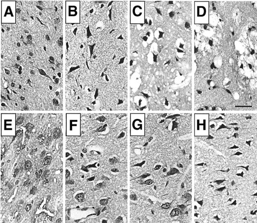 FIG. 1. Representative photomicrographs showing the brain damage in the striatum (A–D) and cortex (E–H) in diabetic animals subjected to 30-min MCA occlusion. In the striatum, compared with the control (A), neuronal necrosis is marked at 30 min (B) while infarction is notable at 3 h (C) and 6 h (D) of reperfusion. In the cortex, the control (E) does not have any damaged neurons, while selective neuronal death is evident after 30 min (F) and 3 h (G), and infarction is evident after 6 h (H) of recovery. Hematoxylin and eosin staining. Bar = 50 μm.