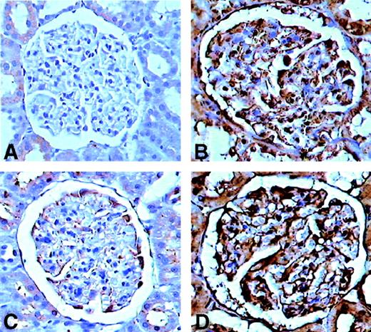 FIG. 5. Immunohistochemical reaction for CML in representative sections of CTR (A), UD rats (B), N+T treated diabetic rats (C), and TAU-treated diabetic rats (D). In the glomeruli of UD rats and of TAU-treated diabetic rats, there is intense staining for CML in the mesangium, basement membrane, and Bowman’s capsule. The tubular epithelium is also intensely positive. There is no CML staining in CTR rats (A); the combined N+T treatment of diabetic rats (C) markedly reduces the CML reaction. Magnification ×420.