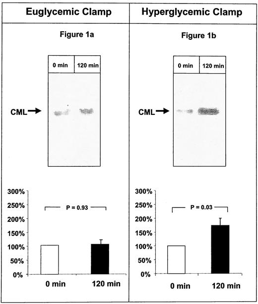 FIG. 1. CML-antigen in PBMCs isolated before and after a euglycemic or hyperglycemic clamp. Cytoplasmic fractions of PBMCs were separated by SDS-PAGE (10% gel) and subjected to immunoblotting with a CML antibody. The Western blot signal of CML antigen obtained before euglycemic (n = 9 volunteers) (A) or hyperglycemic (n = 9 volunteers) (B) clamp was defined as 100% and related to the signal intensity after a euglycemic or hyperglycemic clamp. The Western blot of CML antigen in the cytoplasmic extract of a representative volunteer is shown on top, and the quantification of the CML signals of the whole group (± SD√n) is shown on bottom.