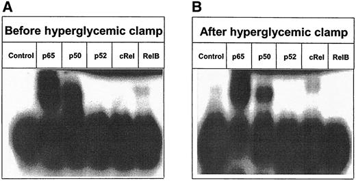 FIG. 5. Relative contribution of the members of the NF-κB family before and after hyperglycemic clamp. Characterization of the NF-κB subunits, contributing to the observed shift, was performed by applying 2.5 μg of anti-p65, anti-p50, anti-p52, anti-cRel, and anti-relB antibodies into the binding reactions using nuclear extract of a representative subject. The complexes were analyzed by EMSA. Panel A shows the relative contribution of the members of the NF-κB family before the hyperglycemic clamp, and panel B shows the contribution after the hyperglycemic clamp. Control = no antibody added.