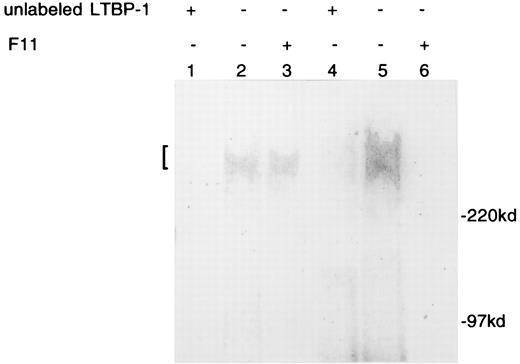 FIG. 2. Binding of LTBP-1 with control and diabetic SMCs. SMC was preincubated with excess of unlabeled LTBP-1 (lanes 1 and 4) or with F11 (lanes 3 and 6). Then, control SMC (lanes 1, 2, and 3) and diabetic SMC (lanes 4, 5, and 6) were cross-linked with 125l-LTBP-1. Molecular size is indicated on the right and “[” shows the specific binding complex of LTBP-1 with SMC detected in lanes 2, 3, and 5. The experiments were performed with five different pairs of control and diabetic SMCs, and typical results are shown.