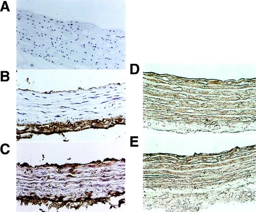 FIG. 3. Immunohistochemical study of integrin-β3 and LTBP-1 in aortas from control and diabetic rats. Nonimmune serum was used in aorta of diabetic rat (A), F11 was applied in aortas of control (B) and diabetic (C) rat, and Ab39 was in those of control (D) and diabetic (E) rat.