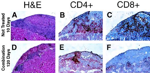 FIG. 3. Histopathological analysis of islet grafts. Islet grafts were collected from control NOD mice 10 days posttransplantation (A–C) or from NOD mice that were treated with the anti-CD45RB and anti-CD154 mAb therapy 120 days after transplantation (D–F). Hematoxylin and eosin staining (H&E) was performed on paraffin-embedded sections (A and D). Immunohistochemistry for CD4+ (B and E) and CD8+ (C and F) T-cell subsets was performed on frozen sections. Control animals showed a classic pattern of rejection, with mononuclear cells infiltrating the graft, and loss of islet morphology. Conversely, recipients treated with anti-CD45RB and anti-CD154 mAb therapy showed only peri-insular mononuclear infiltration, with preservation of islet structure. A remarkable reduction in CD8+ T-cell was also observed in this group, in grafts analyzed both at 10 days (not shown) and after 120 days posttransplantation. CD4+ cells were equally represented in both groups.