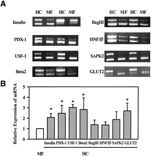 FIG. 5. Gene expression of preproinsulin (insulin), PDX-1, USF-1, β2, RegIII, HNF3β, SAPK2, and GLUT2 in islets isolated from 28-day-old 2-HC and age-matched MF rats. A: Representative gel micrographs for mRNA levels. The upper band corresponds to the cDNA for each gene, and the lower band corresponds to the competitor DNA for the same gene. B: The means of relative densitometric scan values from quantification of mRNA levels. The expression value for the mRNA of each gene from MF islets was arbitrarily taken as 1. Values are the means ± SE of four independent experiments. *P < 0.05.