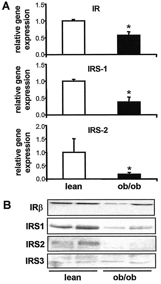 FIG. 5. Hepatic gene expression levels (A) and phosphorylation (B) of the IR and IRS isoforms in lean and ob/ob mice. *P < 0.05, Mann-Whitney U test.