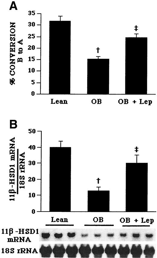 FIG. 1. 11β-HSD1 activity and mRNA expression in the livers of lean mice treated with saline (Lean, n = 8), ob/ob mice treated with saline (OB, n = 9), and ob/ob mice treated with leptin (OB + Lep, n = 8). Values are means ± SE A: Enzyme activity is expressed as the percentage conversion of [3H]B to [3H]A. B: Expression and relative quantitation of enzyme mRNA levels expressed relative to the amount of 18S rRNA. †P < 0.001 vs. lean controls; ‡P < 0.01 vs. ob/ob mice.