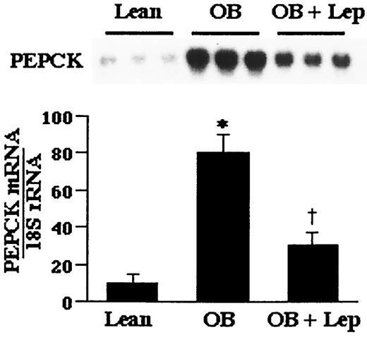 FIG. 2. Northern blot hybridization demonstrating the alterations of PEPCK mRNA expression and relative quantitation of PEPCK mRNA levels in livers of lean littermates treated with saline (Lean, n = 8), ob/ob mice treated with saline (OB, n = 9), and ob/ob mice treated with leptin (OB + Lep, n = 8). Values are means ± SE for the ratio of PEPCK mRNA to 18S rRNA. *P < 0.001 vs. lean controls; †P < 0.01 vs. saline ob/ob mice.