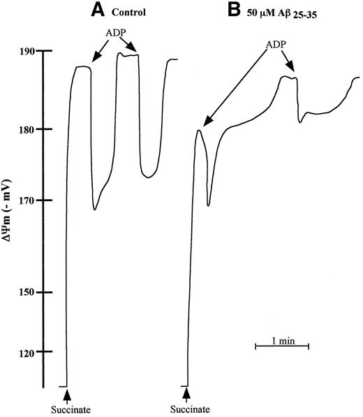 FIG. 3. Representative trace of the effect of Aβ25–35 on ΔΨm, repolarization lag phase, and repolarization level of mitochondria isolated from 24-month-old GK rats. Freshly isolated brain mitochondria (0.8 mg) in 1 ml of the standard medium supplemented with 3 μmol/l TPP+ and 2 μmol/l rotenone were energized with 5 mmol/l succinate. Isolates were preincubated with 50 μmol/l Aβ25–35 for 5 min at 30°C before mitochondria energization.