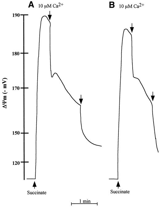 FIG. 6. Effect of Aβ25–35 on ΔΨm of mitochondria isolated from 24-month-old GK rats. Freshly isolated brain mitochondria (0.8 mg) in 1 ml of the standard medium supplemented with 3 μmol/l TPP+ and 2 μmol/l rotenone were energized with 5 mmol/l succinate. A: Control. B: 50 μmol/l Aβ25–35 was preincubated for 5 min at 30°C before mitochondria energization. Ca2+ (100 μmol/l) was added 1 min after mitochondria energization. The traces are typical of three experiments.