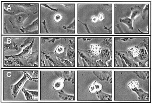 FIG. 1. A: Cell replication: a flattened HeLa cell is rounding up and dividing into two daughter cells, which reestablish to the culture dish. B: Apoptosis in nondividing cells: a flattened cell is rounding up and is at this point morphologically identical to the cell in A; the cell in B in contrast undergoes apoptosis with classical morphological changes such as blebbing of the plasma membrane, shrinkage, and fragmentation into apoptotic bodies. C: Apoptosis in replicating cells: a flattened cell is rounding up and dividing into two daughter cells that then undergo apoptosis.
