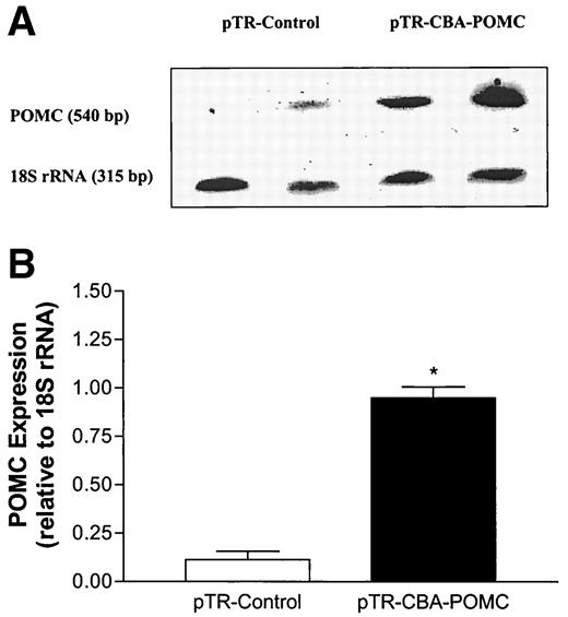 FIG. 1. POMC expression in HEK 293 cells 24 h after pTR-CBA-POMC or pTR-control transfection. A: Representative image of relative quantitative RT-PCR analysis of POMC mRNA expression with 18S rRNA as an internal standard. B: Quantification of POMC mRNA normalized to 18S rRNA. Data represent mean ± SE from three experiments. *P < 0.001 vs. control by unpaired t test.