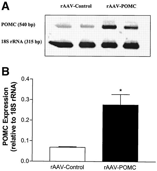 FIG. 2. Hypothalamic POMC expression 38 days after rAAV-POMC or control vector delivery in obese Zucker rats. A: Representative image of relative quantitative RT-PCR analysis of hypothalamic POMC mRNA with 18S rRNA as an internal standard. B: Quantification of POMC mRNA normalized to 18S rRNA. Data represent mean ± SE from six rats per group. *P < 0.02 vs. control by unpaired t test.