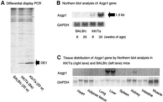 FIG. 1. A: Six percent denaturing polyacrylamide gel containing normal BALB/c and diabetic KK/Ta mice kidney cDNA after DD PCR. Lane 1: Amplification products from BALB/c mice kidney cDNA; lanes 2 and 3: amplification products from KK/Ta mouse kidney cDNA. The arrow indicates a 206-bp cDNA that age-dependently increased in diabetic kidney samples. The amplified cDNA fragment (DE1) is complementary to mouse Azgp1 mRNA. B: Northern blot analysis of BALB/c and KK/Ta mouse kidney probed with DE1 and GAPDH. Each lane contained 10 μg RNA from total kidney of BALB/c (8 and 20 weeks of age) and KK/Ta (8 and 20 weeks of age) mice. The DE1 probe recognized an mRNA of 1.3 kb. C: Comparison of Azgp1 mRNA expression in the heart, lungs, spleen, liver, kidneys, intestine, muscle, and adipose tissue of BALB/c and KK/Ta mice. Each lane (right: KK/Ta; left: BALB/c) contained 10 μg RNA from each tissue of BALB/c (20 weeks of age) and KK/Ta (20 weeks of age) mice. These densitometry analyses are representative of three separate experiments with quantitatively similar results.