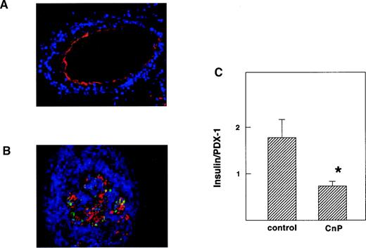 FIG. 3. Effect of conophylline on the expression of PDX-1 and insulin. Pancreatic rudiments were cultured for 10 days in the absence (A) or presence (B) of 100 ng/ml conophylline. Sections were stained with anti–PDX-1 (green) and anti-insulin (red) antibodies. Nuclei were stained with 4,6-diamidio-2-phenylindol-HCl (DAPI) (blue). PDX-1/insulin double-positive cells are in yellow. A and B: magnified 200×. C: Quantitative analysis. The ratio of the insulin-positive cell area to the PDX-1–positive cell area was calculated. Values are means ± SE obtained in four rudiments. *P < 0.05 vs. control.