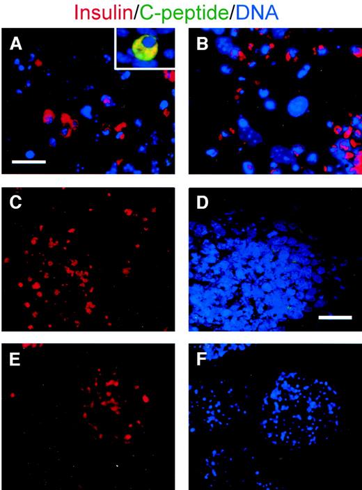 FIG. 2. Lack of C-peptide expression in cells that were immunoreactive for insulin. Immunofluorescence staining for insulin and C-peptide. Insulin but not C-peptide is detected in differentiated cells. A and B: Differentiated mouse ES cells (OS25) that were cultured according to protocol 1 (A) and cells that were cultured according to protocol 2 (B). MIN6 cells, in which a clear colocalization of insulin and C-peptide is observed, were used as positive control (A, insert). C and D: Human ES cells that were cultured according to protocol 1. Green signal in D is background. E and F: Mouse-derived ES cells that were cultured according to protocol 3. Scale bars: 20 μm in A; 30 μm in D.