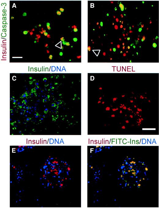 FIG. 3. Insulin-immunoreactive cells are apoptotic and take up insulin from the culture media. Insulin+ differentiated OS25 ES cells that were cultured according to the protocol 1 (A) and cells that were cultured according to protocol 2 (B) express the apoptotic marker cleaved caspase-3 (arrowheads). C and D: Insulin-containing cell clusters that were derived from human ES cells that were cultured according to protocol 1 have small, condensed nuclei and are TUNEL+. E and F: Mouse-derived ES cells that were cultured according to protocol 3 take up FITC-labeled insulin when present in the culture media. Scale bars: 20 μm in A; 30 μm in D.