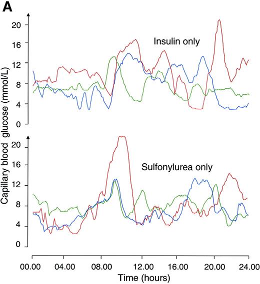 FIG. 3. Frequent capillary glucose measurements in two patients with PND caused by mutations in the gene encoding Kir6.2. A continuous glucose measuring system was recorded in subjects N92 (F333I) (A) and AA (R201H) (B) on 3 consecutive days (one color for each day) before the trial (on insulin only) and 1 month after insulin was discontinued (on sulfonylurea only).
