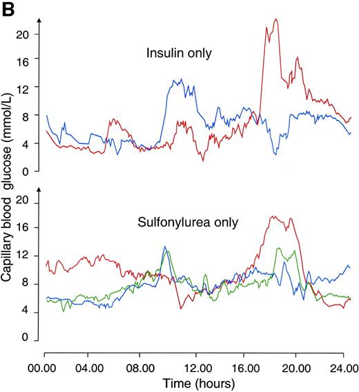 FIG. 3. Frequent capillary glucose measurements in two patients with PND caused by mutations in the gene encoding Kir6.2. A continuous glucose measuring system was recorded in subjects N92 (F333I) (A) and AA (R201H) (B) on 3 consecutive days (one color for each day) before the trial (on insulin only) and 1 month after insulin was discontinued (on sulfonylurea only).