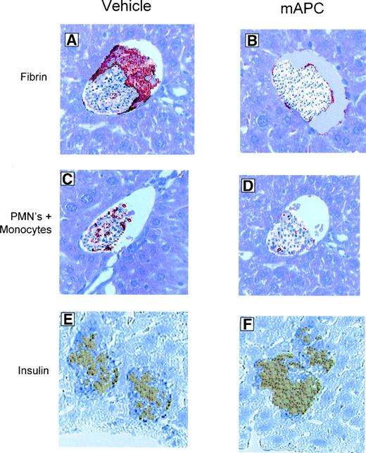 FIG. 5. Immunohistochemistry evaluation of fibrin and CD11b deposition and insulin content for syngeneic intraportally infused islets in diabetic recipients given vehicle versus mAPC. Livers from islet transplant recipients were fixed 6 h after the transplant in paraformaldehyde or snap frozen in liquid nitrogen. Five-micron-thick sections were mounted on glass slides. Sections were stained with horseradish peroxidase–conjugated anti-fibrin II antibody (A and B), anti-CD11b antibody (C and D), and anti-insulin antibody (10 days after the transplant) (E and F) and counterstained with hematoxylin and eosin as described in research design and methods. Recipients were treated with either vehicle (A, C, and E) or mAPC (0.2 mg/kg i.v. at 1 h before the transplant) (B, D, and F) (magnification ×100).