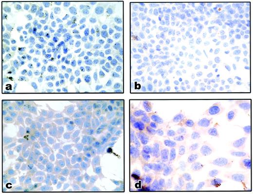 FIG. 2. Immunohistochemical localization of OGT in cultured hepatoma cells. All sections reacted with HRP-DAB system (see research design and methods). The reaction product demonstrating the localization of the antigen is brown. Sections counterstained with hematoxylin are blue. a: Cultured cells without any hormonal treatment (control cells). The cytoplasm contains barely detectable levels of OGT. b: Glucagon-treated cells. Compared with control cells (a), there is minimally increased cytoplasmic staining. c: Insulin-treated cells. All cells contain clearly demonstrable OGT. d: Insulin-treated cells with higher magnification, demonstrating the diffuse cytoplasmic staining. Some nuclear reactivity could be obscured by the hematoxylin stain. Magnification ×400 (a, b, and c) and ×600 (d).