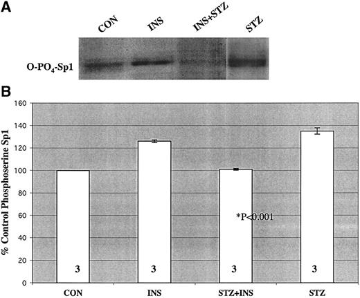 FIG. 5. Effect of STZ on phosphorylation of Sp1 in the presence of insulin. H411E cells were treated with or without insulin (10,000 μU/ml) in the presence of STZ (5 mmol/l) as described. As detailed in research design and methods, the immunoprecipitated Sp1 was subjected to SDS-PAGE, and Western blot analysis was performed using anti-phosphoserine antibody. A: Densitometrically analyzed values of the blots normalized from multiple experiments are presented. B: Quantitation of the data in A from three experiments.