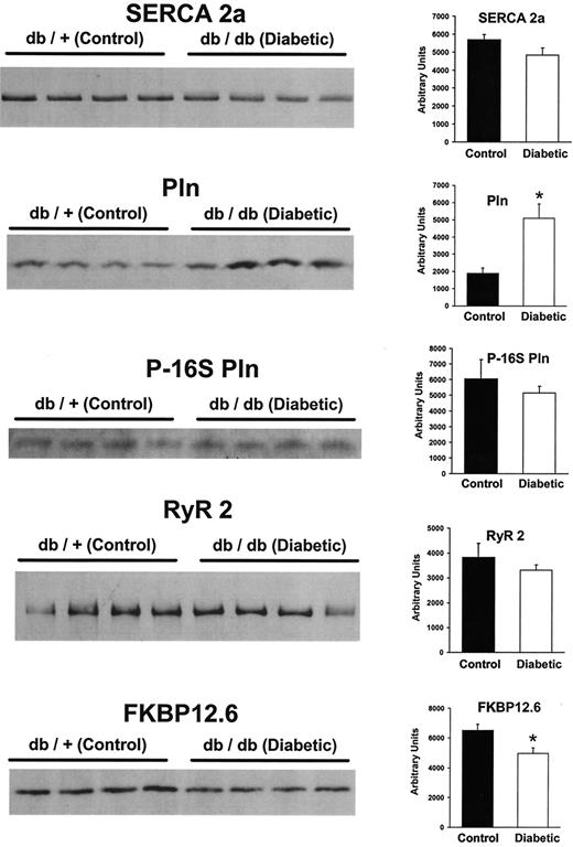 FIG. 5. Western blots of various SR proteins obtained from control and diabetic hearts. SERCA2a protein content was slightly (NS) decreased in the diabetic group (average densitometric scan values shown to the right of the blot). In contrast, phospholamban (Pln) levels were two to three times higher in the diabetic group. Results of the analysis of the phosphorylation status of serine residue 16 of Pln (P-16S Pln) were not different between the groups. The expression of the ryanodine receptor (RyR2) did not differ between the two groups; however, a significant decrease in FKBP 12.6 was observed. All lanes were loaded with 20 μg protein, with the exception of the RyR2 blot, where lanes were loaded with 50 μg protein. *P < 0.05.