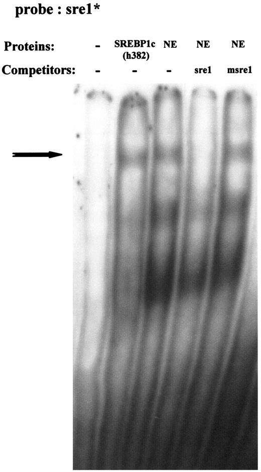 FIG. 4. Electrophoretic mobility shift analysis showing that the −309/−300 SRE of HKII promoter interacts with nuclear proteins prepared from human muscle cells. Electrophoretic mobility shift assays were performed as indicated in research design and methods, with 5′ end-labeled sre1 oligonucleotide in the presence of 15 μg of nuclear proteins prepared from differentiated myotubes. The arrow indicates the specific complex. NE, nuclear extract.